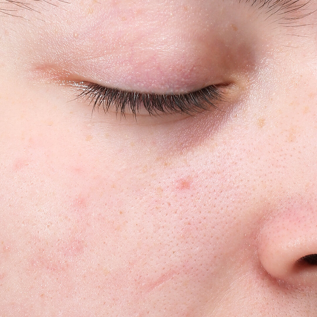 Symphonic M.D. Retinol After